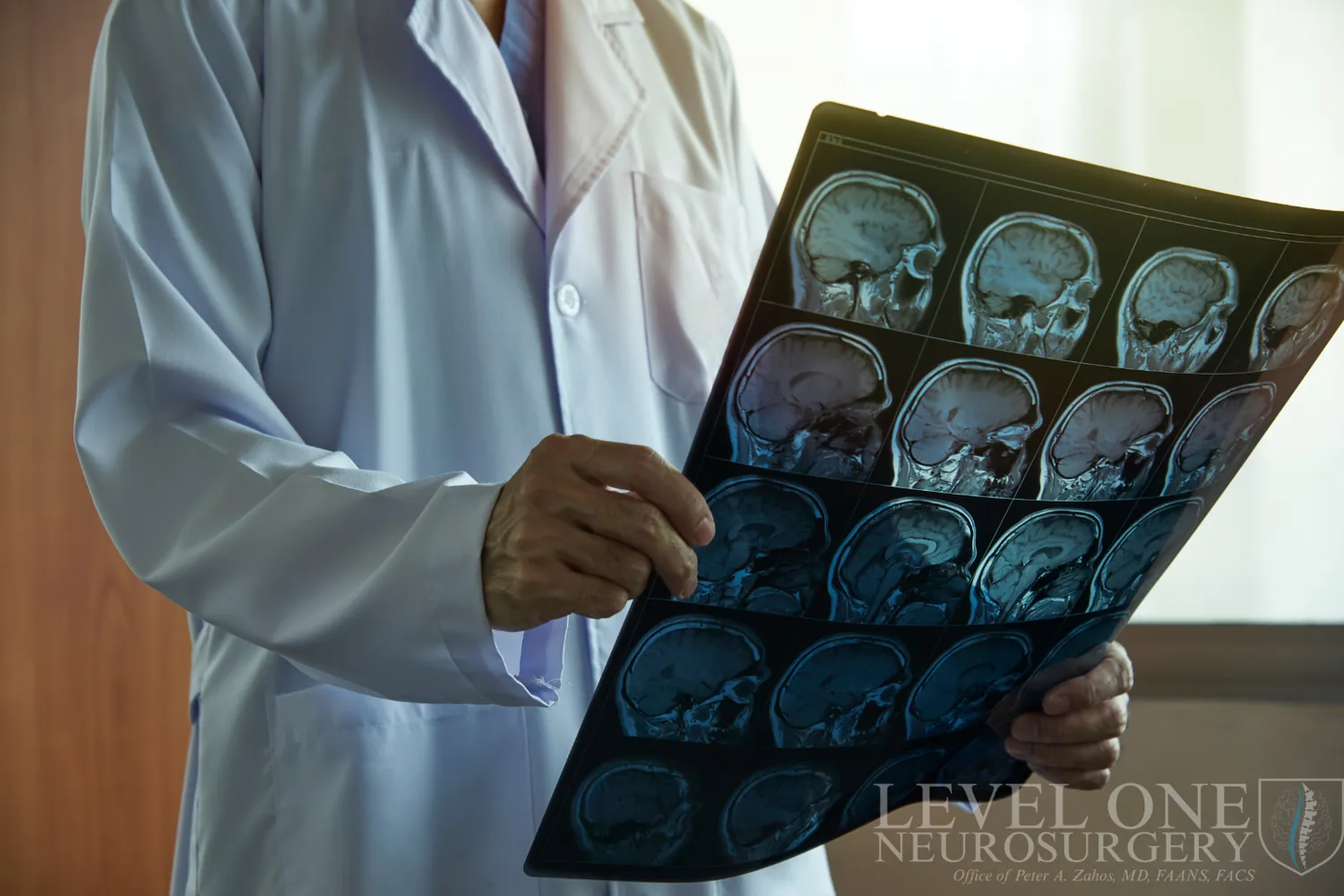 Doctor reviewing MRI scans of the brain